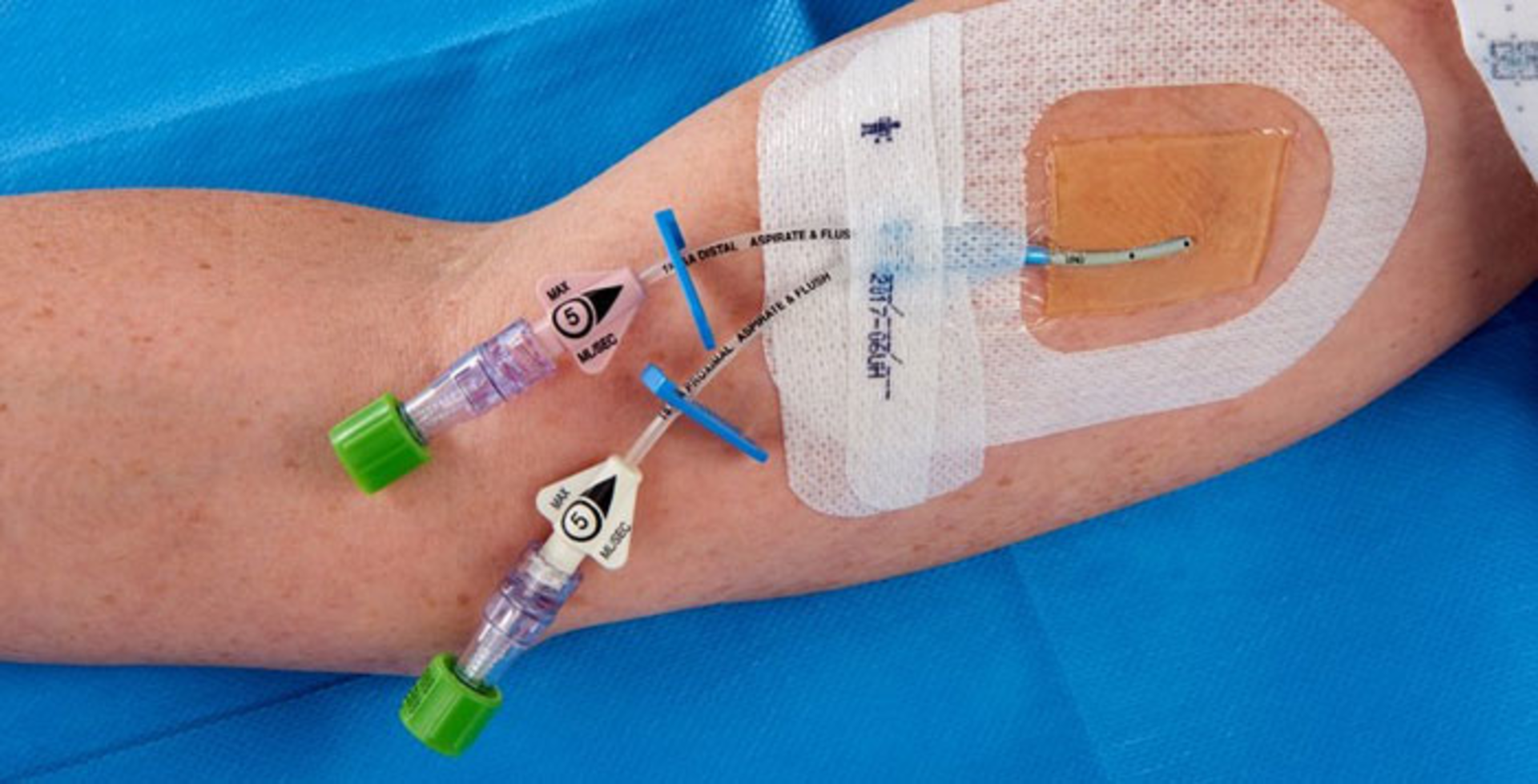 Theraworx Technology&rsquo;s 2-cloth Specialty Care Pack for pH and barrier management