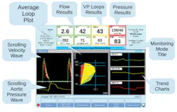 The Deltex TrueVue Loops display gives a complete picture of flow, pressure and resistance The Deltex TrueVue Loops display gives a complete picture of flow, pressure and resistance