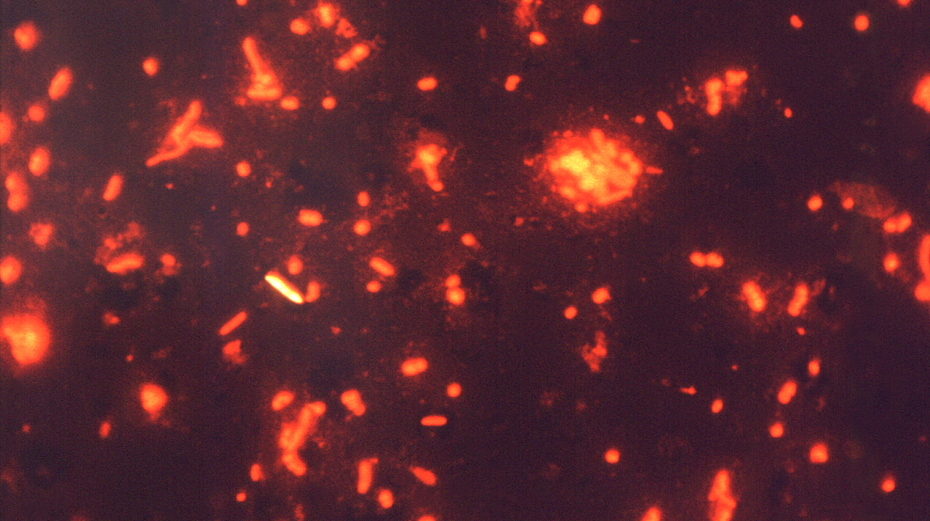 A photomicrograph of a sputum smear reveals the presence tuberculosis bacterium.