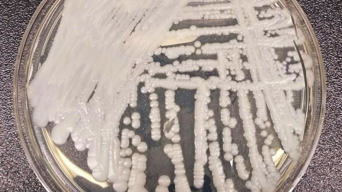 A strain of Candida auris cultured in a petri dish at the Centers for Disease Control and Prevention