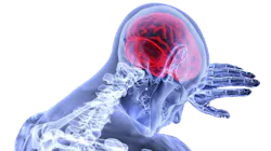 Brain 3168269 1920 5d2c9b136f5bb Brain 3168269 1920 5d2c9b136f5bb