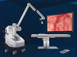 The Olympus ORBEYE 4K 3D orbital camera system The Olympus ORBEYE 4K 3D orbital camera system