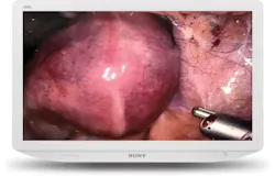 Sony 27” 4K Medical Display Sony 27” 4K Medical Display