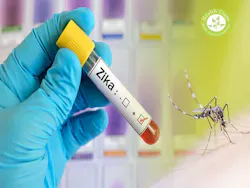 Wustl Researchers Examine Zika S Most Harmful Brain Damage With Brazilian Newborns Pic 2 19 20du 25803060023 7051707569 O Flickr Fda 5e4d5f9fc8f13 Wustl Researchers Examine Zika S Most Harmful Brain Damage With Brazilian Newborns Pic 2 19 20du 25803060023 7051707569 O Flickr Fda 5e4d5f9fc8f13