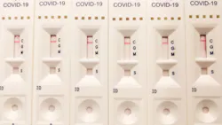 Mayo Clinic Releases Answers On Efficacy Of Antibody Testing For Covid 19 Pic 5 21 20du 49776762141 2b448c8592 K Fda Flickr 5ec686b5438b7 Mayo Clinic Releases Answers On Efficacy Of Antibody Testing For Covid 19 Pic 5 21 20du 49776762141 2b448c8592 K Fda Flickr 5ec686b5438b7
