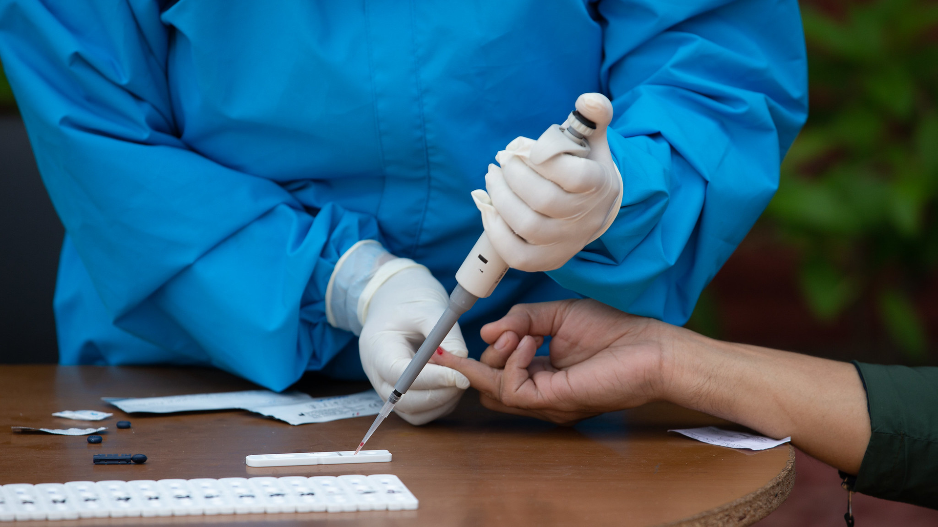 Study Of Antibody Response To Sars Co V 2 Spike Proteins Could Help Inform Vaccine Design Pic 7 14 20du 49865442618 3381f0a4f2 K Fda Flickr 5f0dc32cb0de0