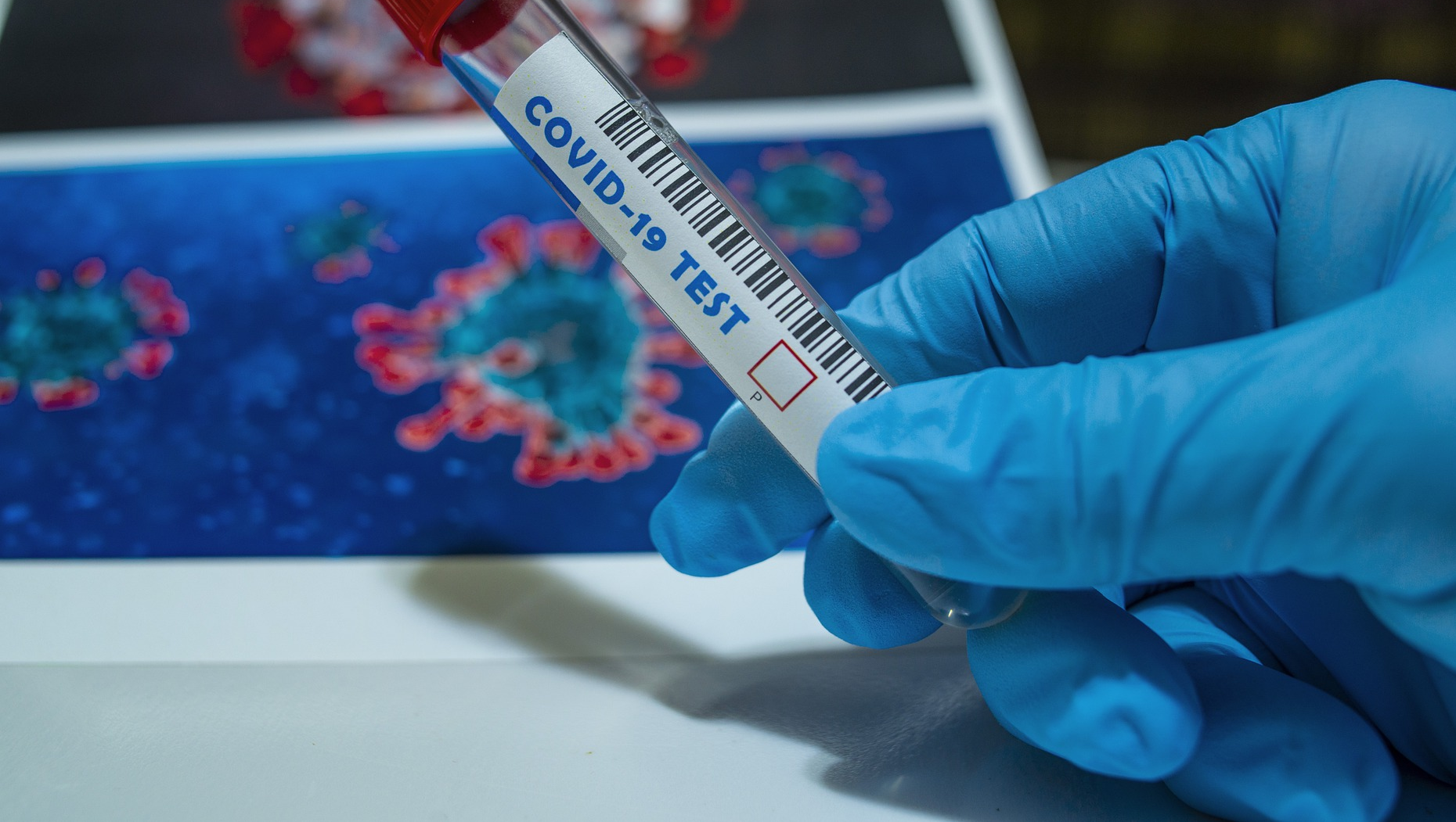 Us Covid 19 Case Counts Rise In 39 States Decline In Only Two Pic 7 17 20du Covid 19 5070658 1920 1 Pixabay 5f11c6380c67e