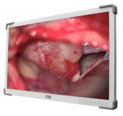 55” monitor from FSN Medical Technologies 55” monitor from FSN Medical Technologies