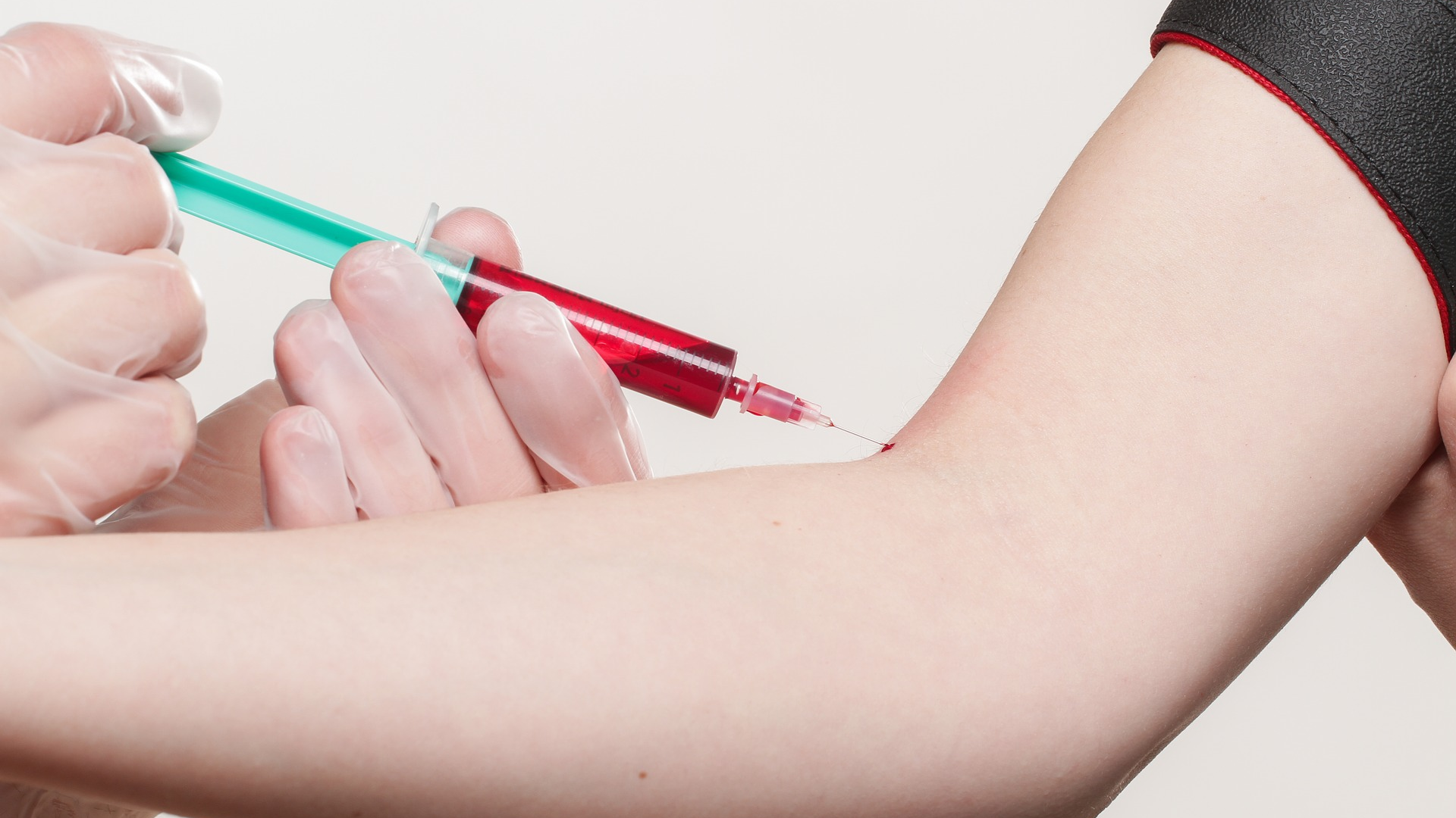 Image by Angelo Esslinger from Pixabay