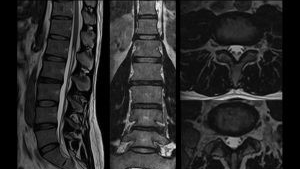 Photo courtesy of Canon Medical Systems USA