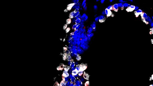 Photo courtesy of Rutgers Cancer Institute of New Jersey