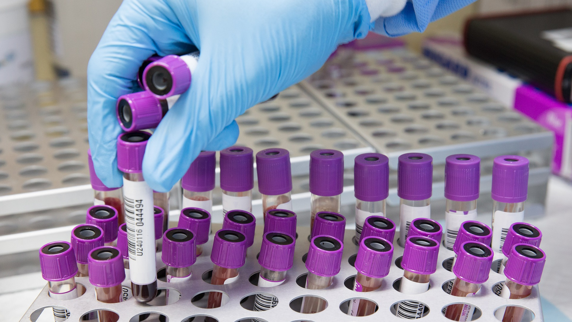 Image by Ahmad Ardity from Pixabay