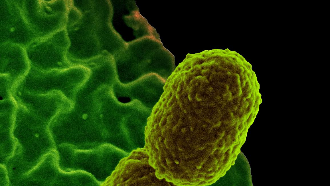 Photo courtesy of NIH