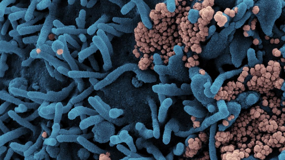 Photo courtesy of NIH and NIAID