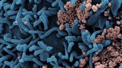 Photo courtesy of NIH and NIAID Photo courtesy of NIH and NIAID