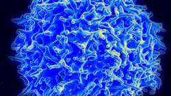 Photo courtesy of NIH and NIAID Photo courtesy of NIH and NIAID