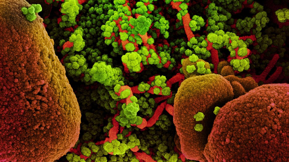 Photo courtesy of NIH and NIAID