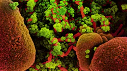 Photo courtesy of NIH and NIAID Photo courtesy of NIH and NIAID