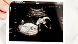 Baby 18937 1920 6140b1d65bfa2 Baby 18937 1920 6140b1d65bfa2