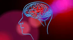 Stroke Gad8072a05 1920 61c08bcb27581 Stroke Gad8072a05 1920 61c08bcb27581