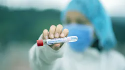 Test Tube 5065425 1920 61f16ef256199 Test Tube 5065425 1920 61f16ef256199