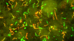 Courtesy of CDC Courtesy of CDC