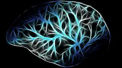 Brain G4d1037d7f 1920 621fafdd91bc8 Brain G4d1037d7f 1920 621fafdd91bc8