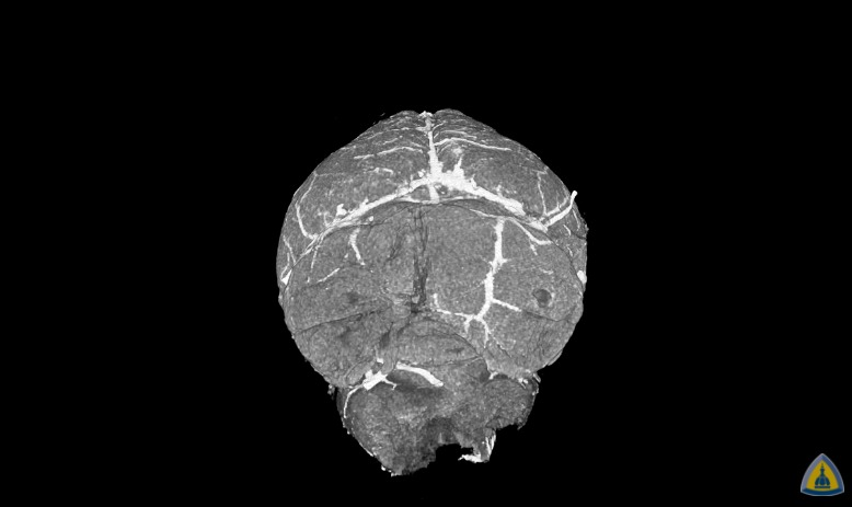 Courtesy of Johns Hopkins