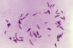 Courtesy of the CDC Courtesy of the CDC