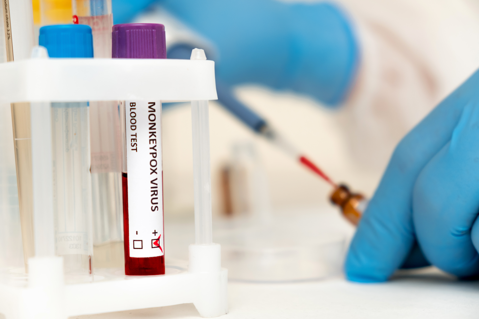 Adobe Stock 507059164 62d6ca3ab8e2a