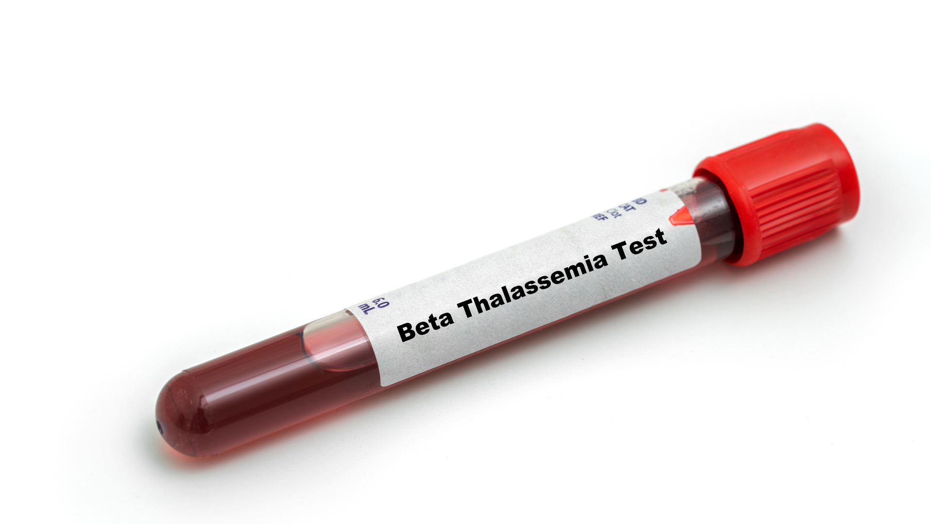 Adobe Stock 503082064 62ff8c3ca8ad2