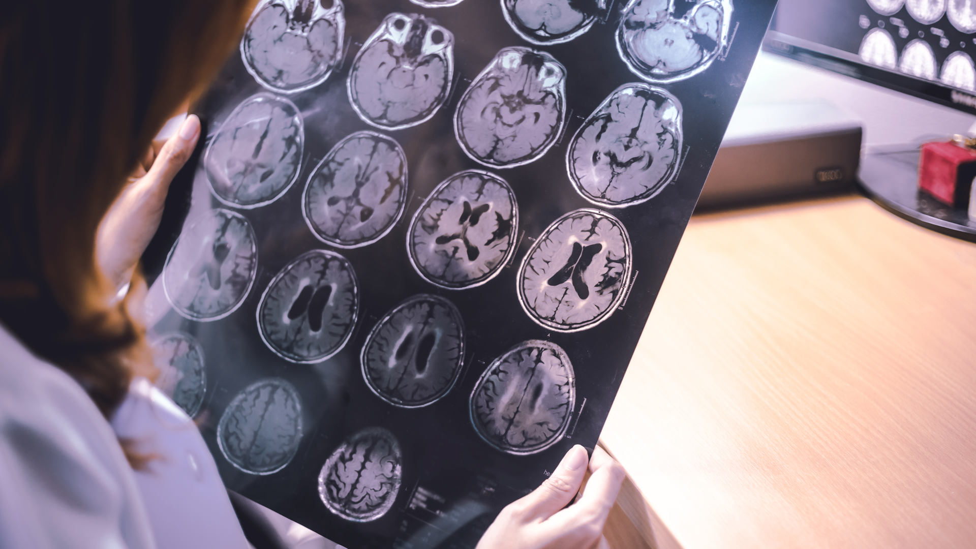 Dreamstime Xxl 105439974 63c16af54f38f