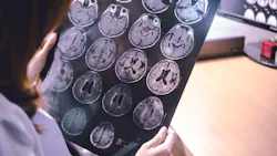 Dreamstime Xxl 105439974 63c16af54f38f Dreamstime Xxl 105439974 63c16af54f38f