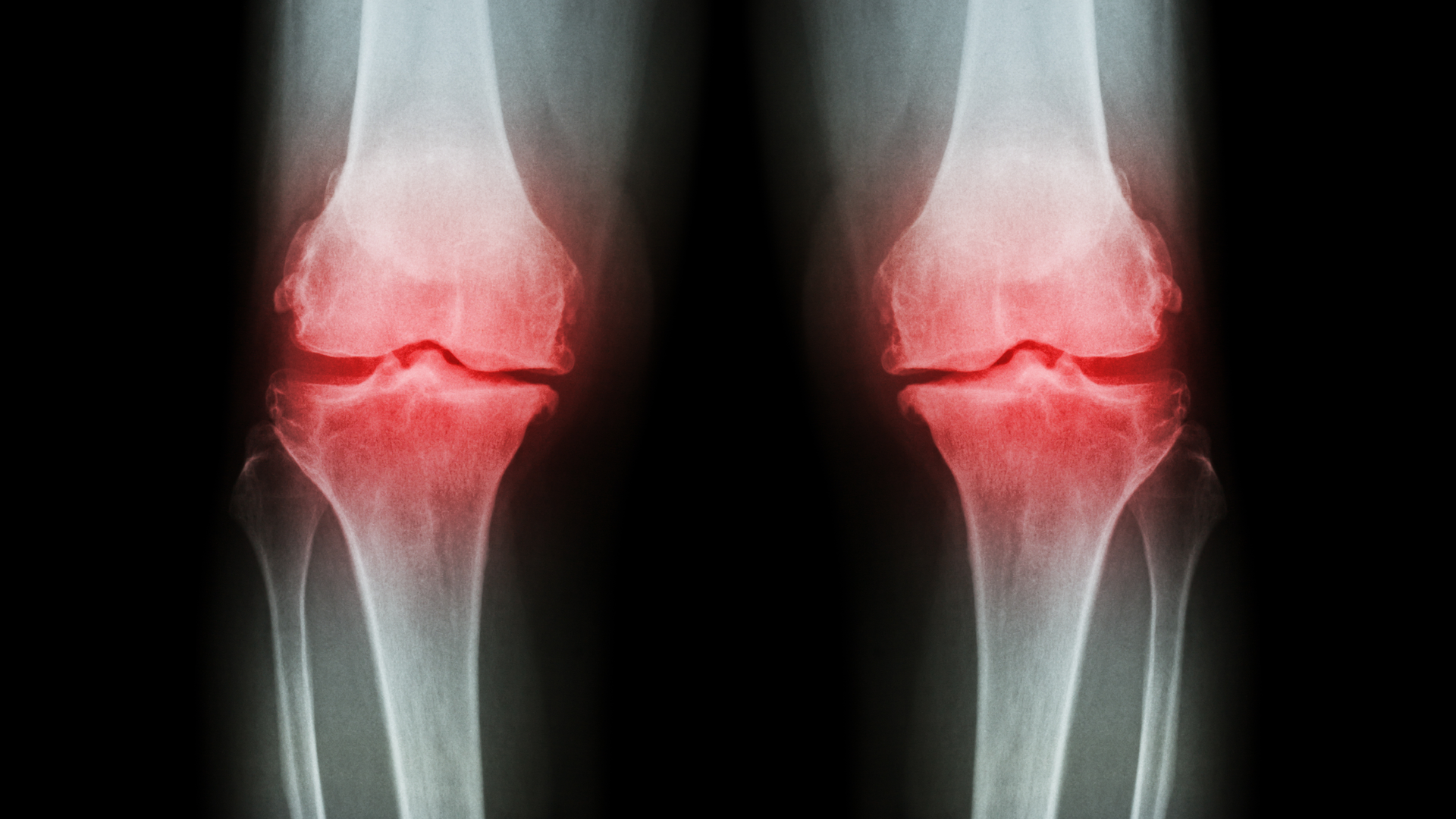 Dreamstime Xxl 59831383 64243d4b51e4d