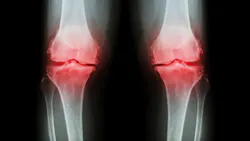 Dreamstime Xxl 59831383 64243d4b51e4d Dreamstime Xxl 59831383 64243d4b51e4d