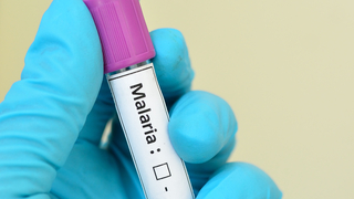 Dreamstime Xs 55650091 644bdd9dd8d3f