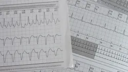 Dreamstime Xxl 212457386 644fc45ea8990 Dreamstime Xxl 212457386 644fc45ea8990