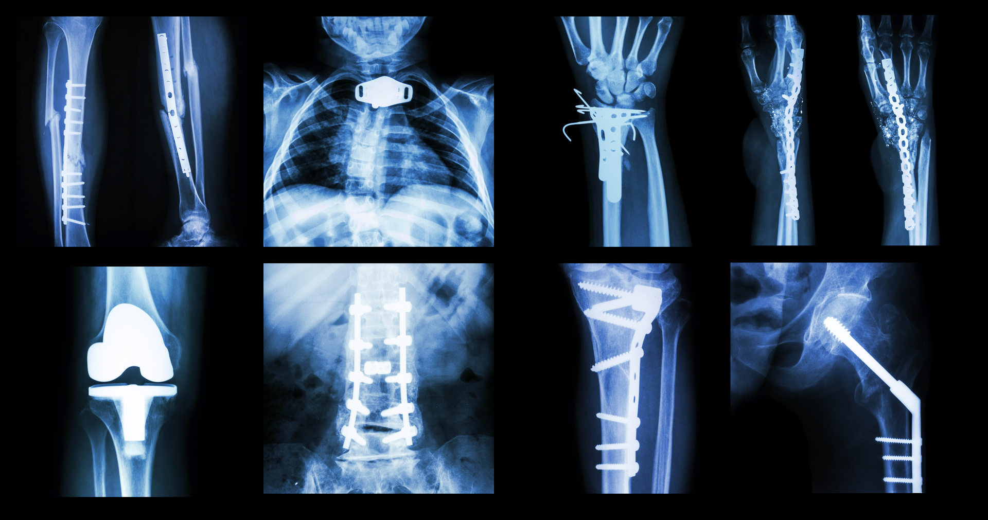 Dreamstime Xxl 48522640 Rearranged 6481d4cae848c