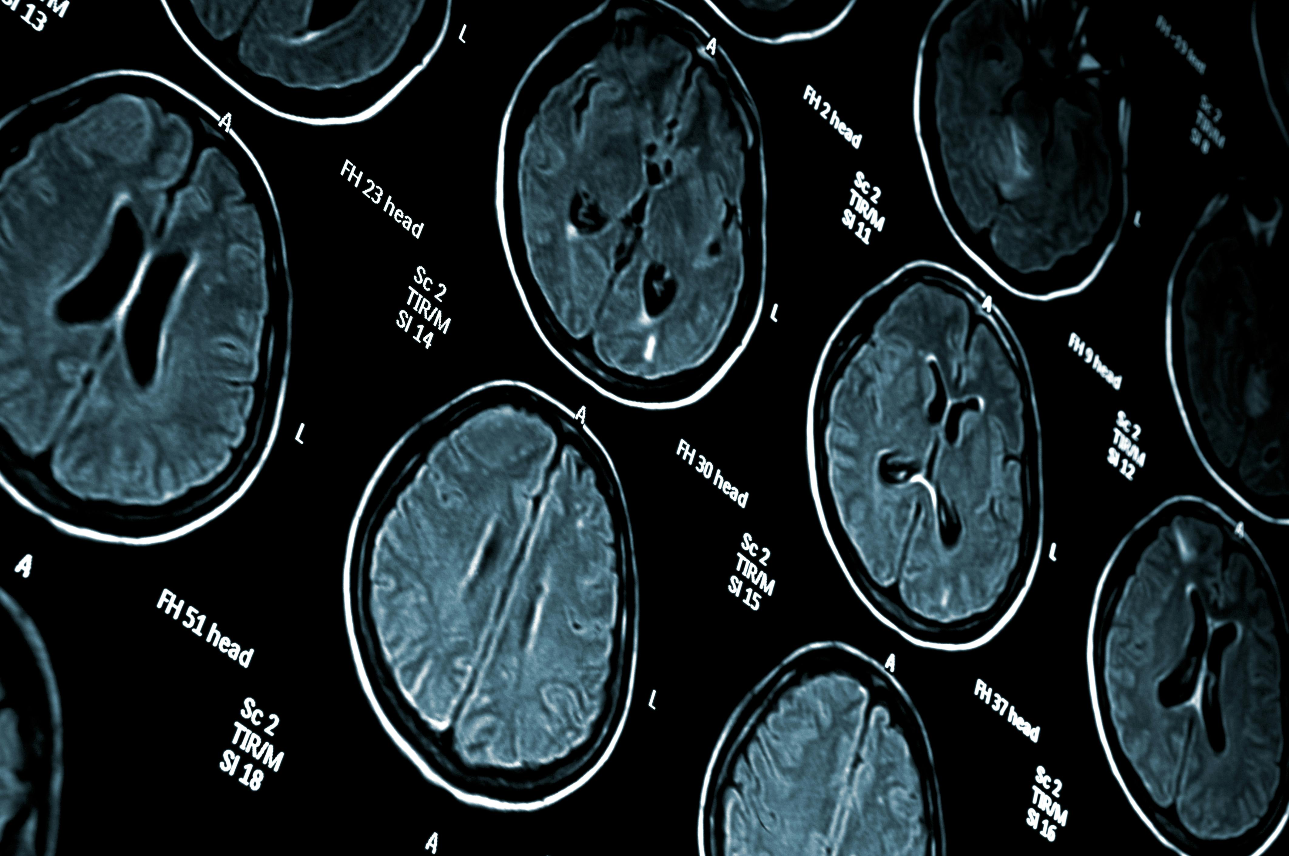 6564ce788d242b001ecb2d66 Dreamstime Xxl 6984998