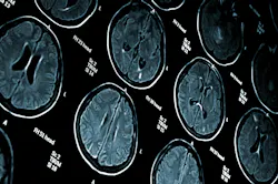 6564ce788d242b001ecb2d66 Dreamstime Xxl 6984998 6564ce788d242b001ecb2d66 Dreamstime Xxl 6984998