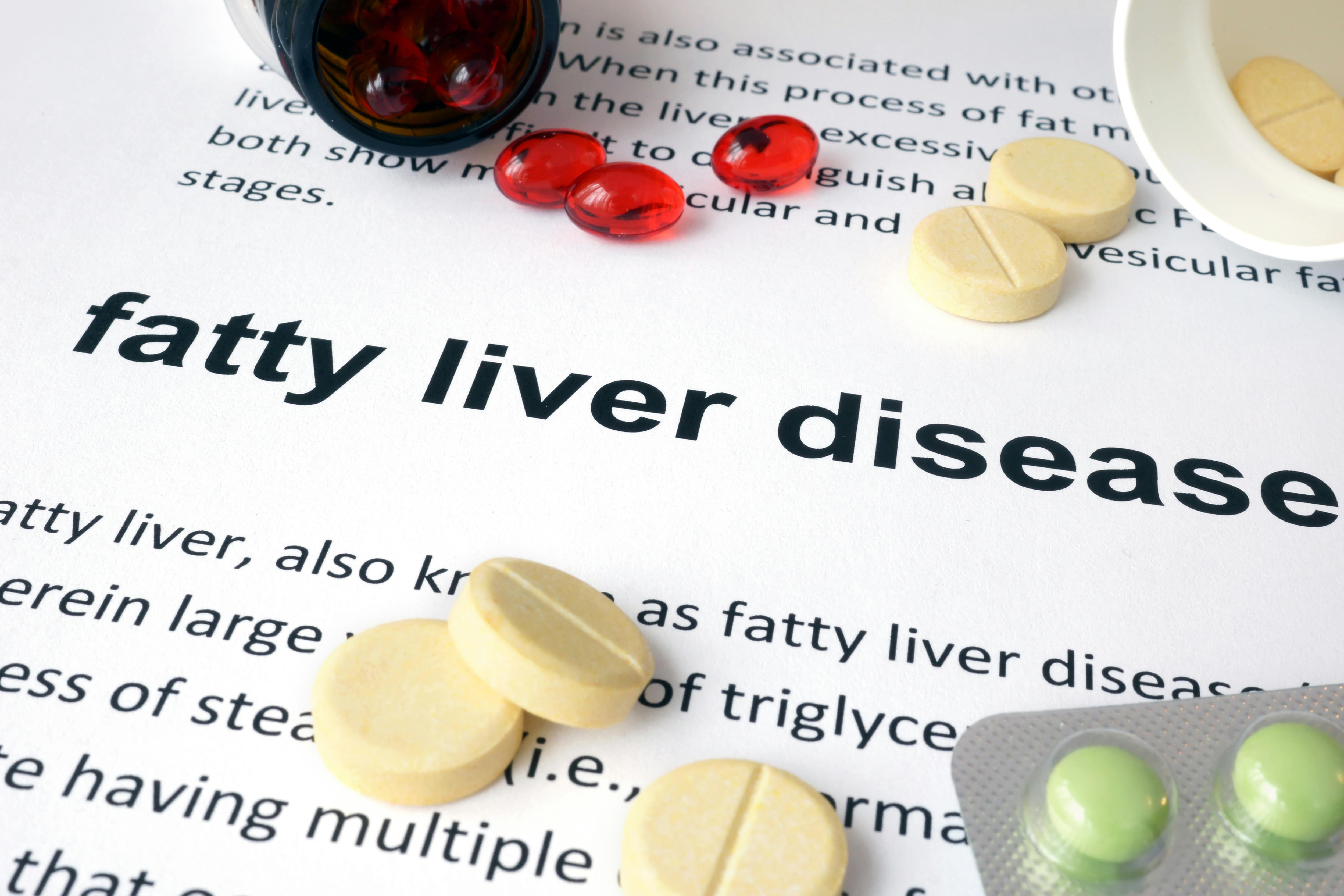 65f45cd599dbc0001e78ab67 Fatty Liver Disease