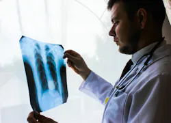 6670653735a6309a351bdc66 Lungs 6670653735a6309a351bdc66 Lungs