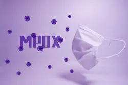 66cf5263dbd04b1f98fe1018 Mpox 2 66cf5263dbd04b1f98fe1018 Mpox 2