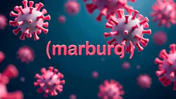 670568966adab91ce887c201 Dreamstime Xxl 339478847 670568966adab91ce887c201 Dreamstime Xxl 339478847