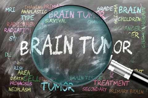 673cd100a92c3d33e679ed79 Brain Tumor