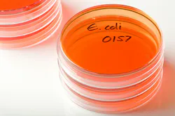 68ffa79cc8dafd83a179e971 E Coli 68ffa79cc8dafd83a179e971 E Coli