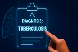 698f5c03f49e22ecef07b13c Tuberculosis 2 698f5c03f49e22ecef07b13c Tuberculosis 2