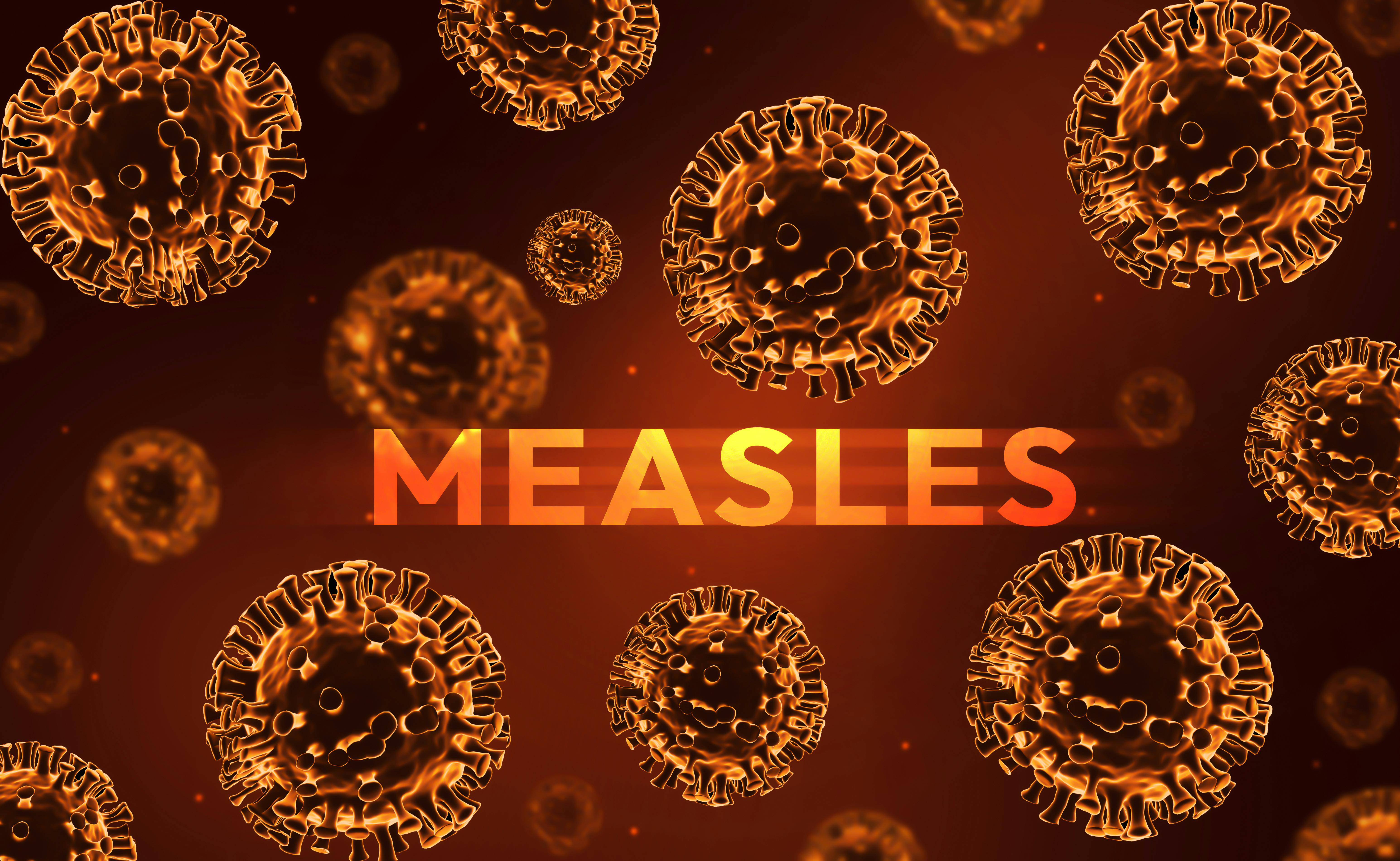 699c8470e56de6eedc46c46c Measles 3