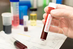 Coronavirus 5e3486e9a613e Coronavirus 5e3486e9a613e