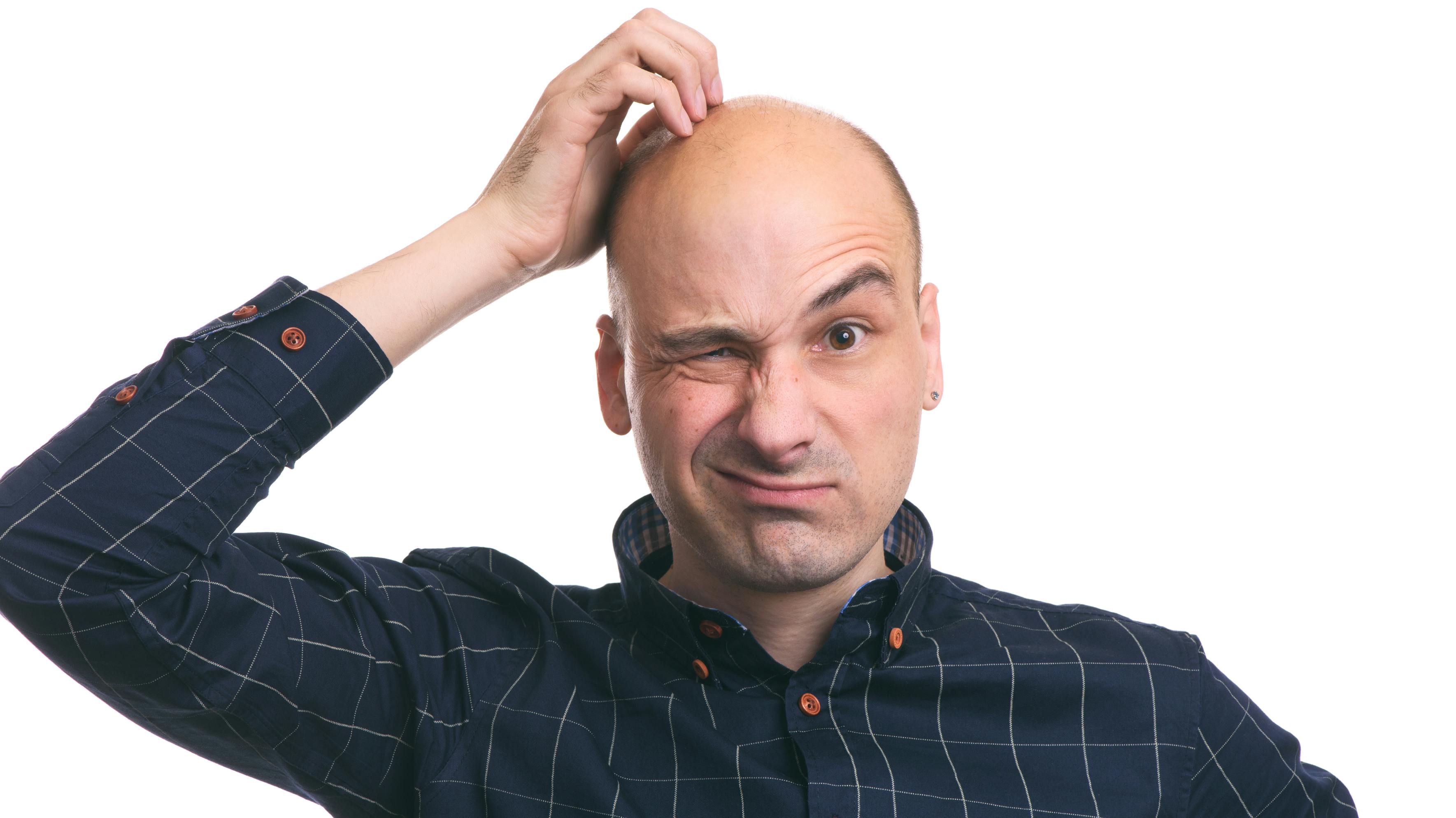 Photo of a man with a confused facial expression scratching his head.